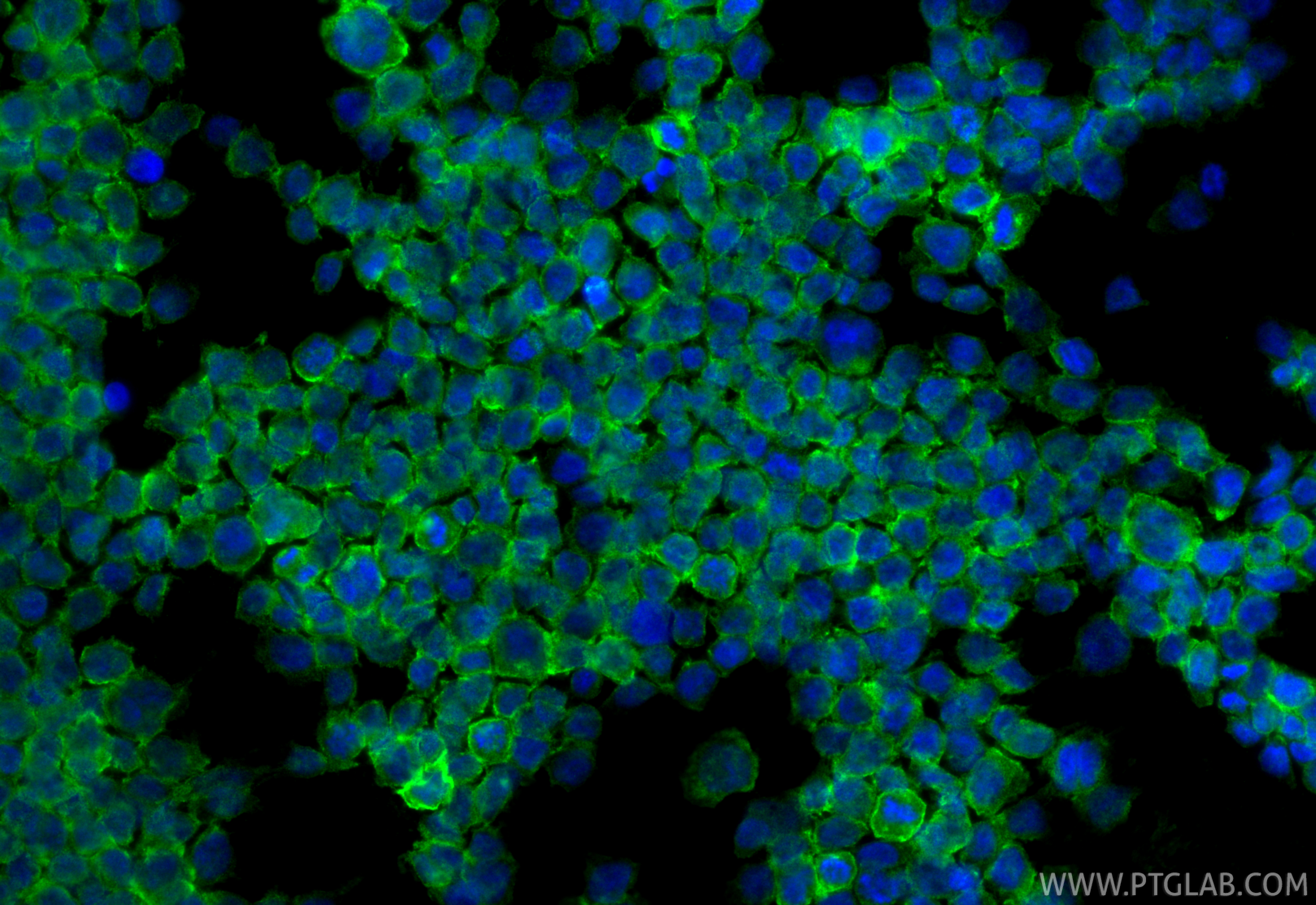 IF Staining of THP-1 using 28422-1-AP IF Staining of THP-1 using 28422-1-AP