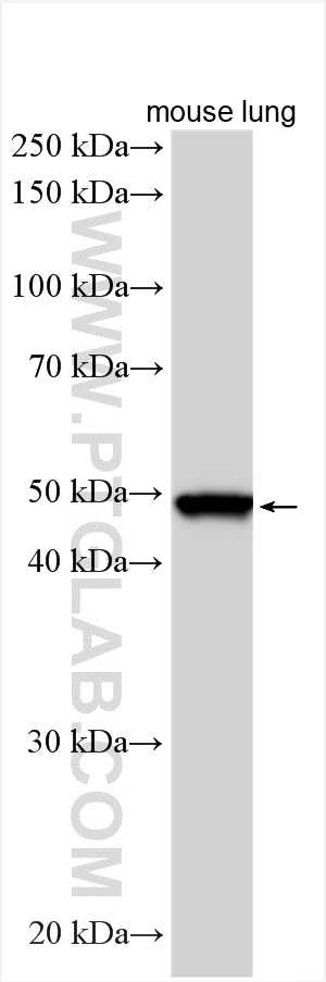 WB analysis using 28422-1-AP