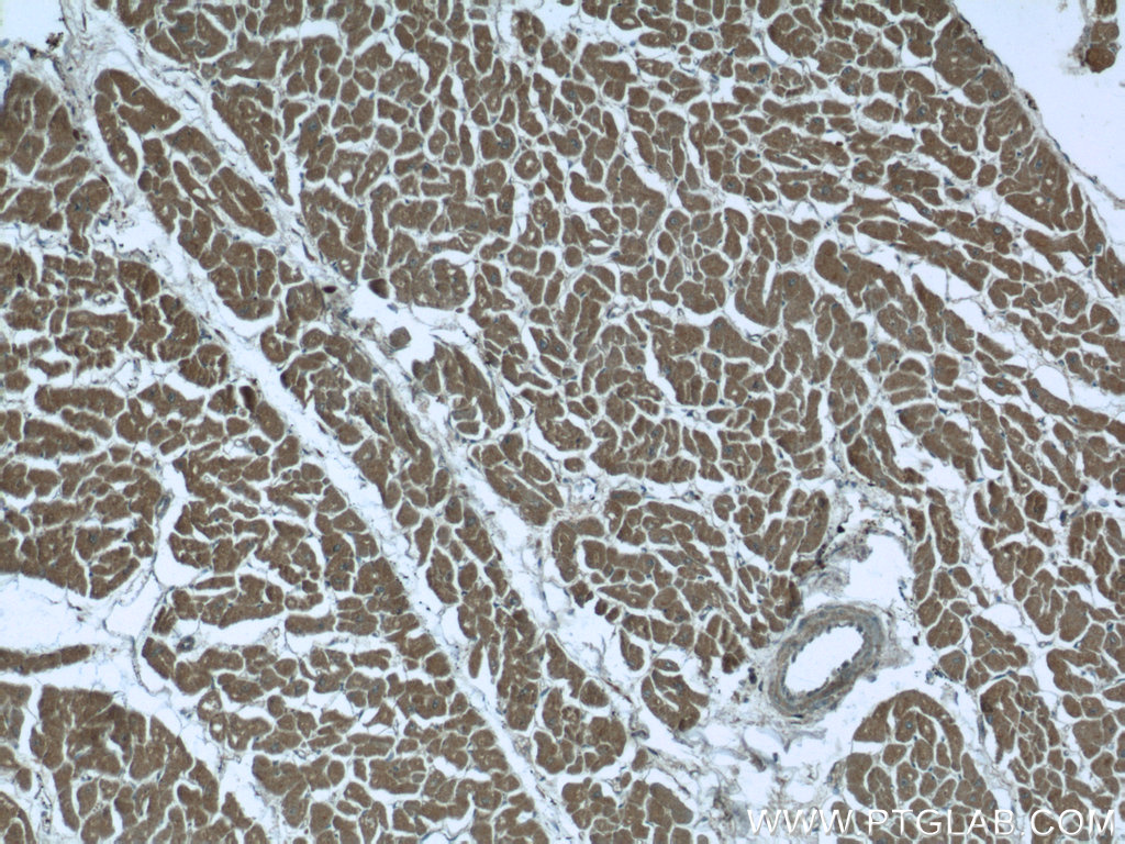 IHC staining of human heart using 24738-1-AP