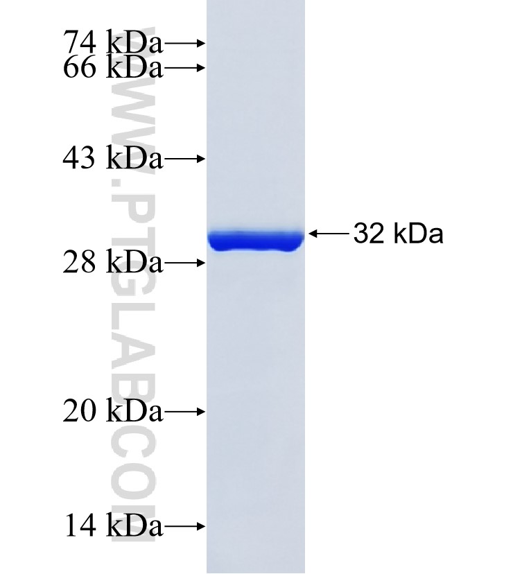 IMAA fusion protein Ag38511 SDS-PAGE IMAA fusion protein Ag38511 SDS-PAGE