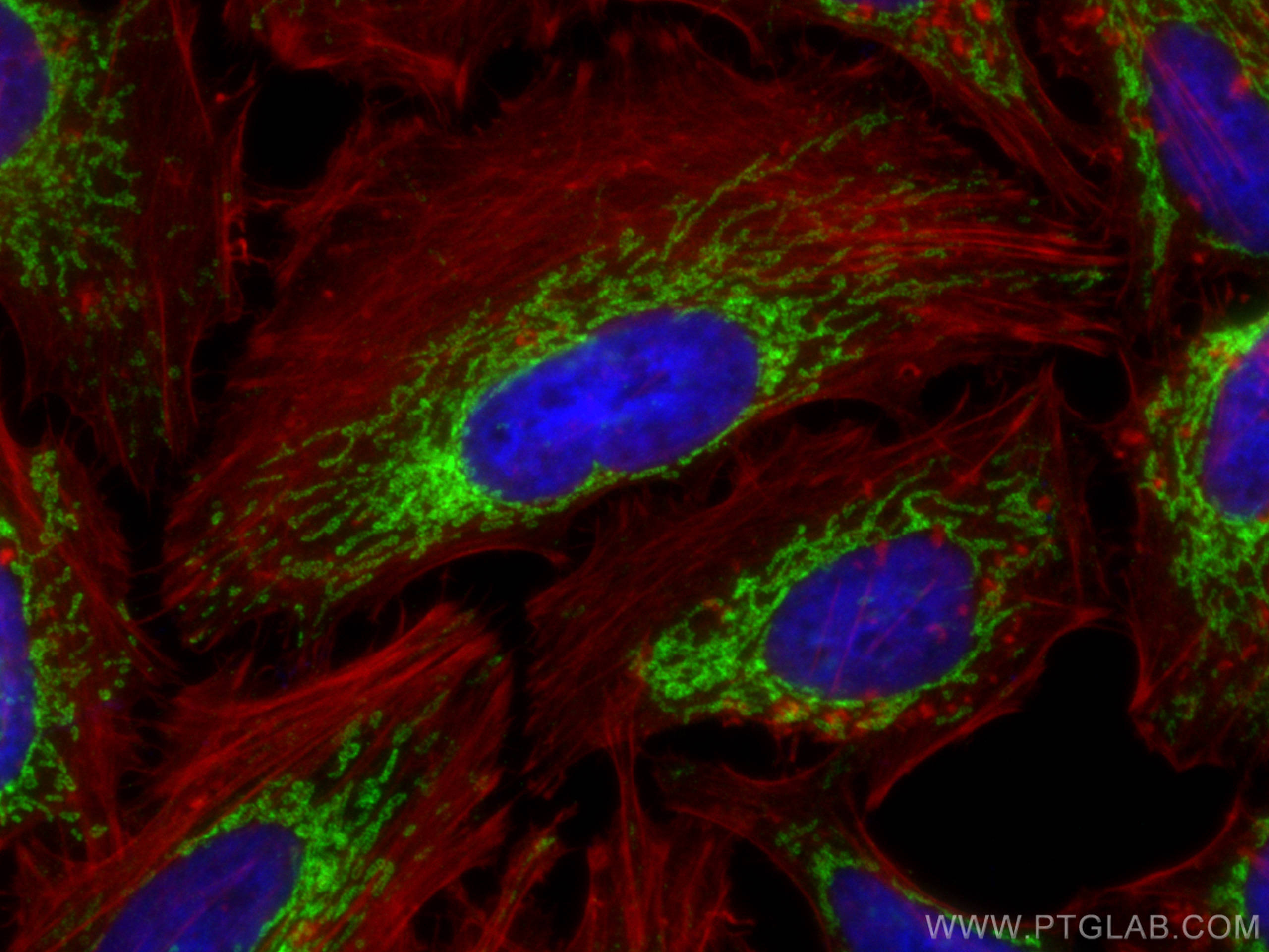 IF Staining of HeLa using 68226-1-Ig (same clone as 68226-1-PBS)