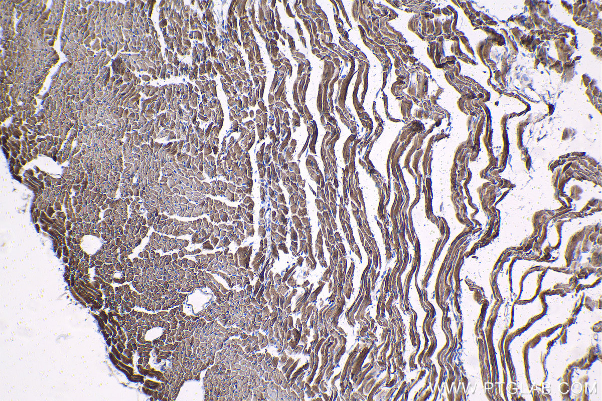 IHC staining of mouse heart using 68226-1-Ig (same clone as 68226-1-PBS)