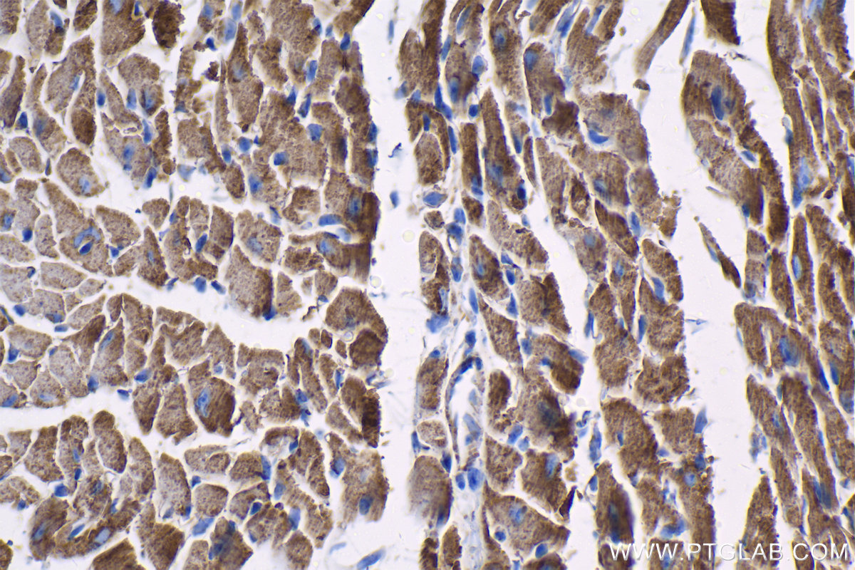 IHC staining of mouse heart using 68226-1-Ig (same clone as 68226-1-PBS)