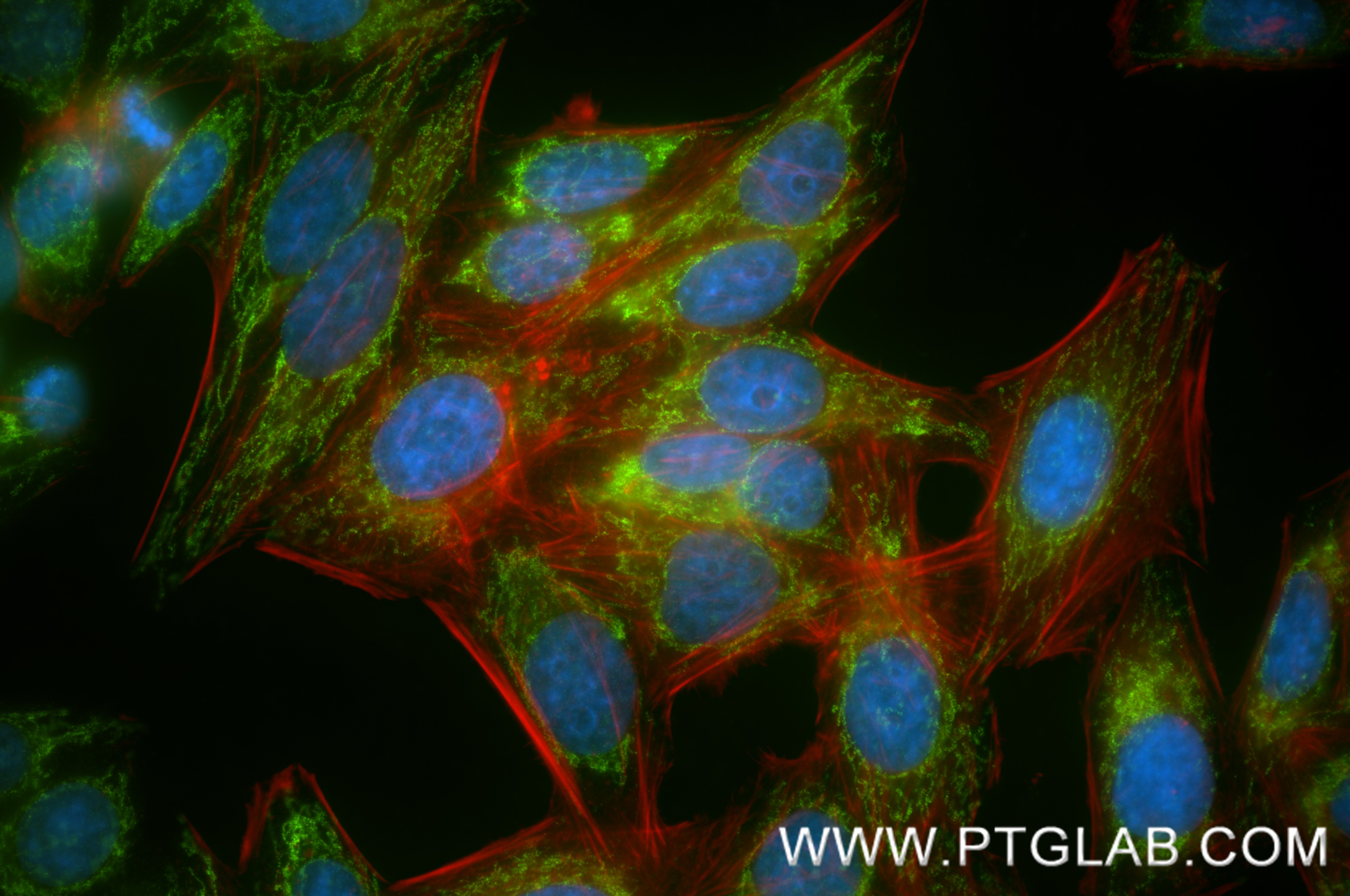 IF Staining of HepG2 using 88213-2-RR (same clone as 88213-2-PBS) IF Staining of HepG2 using 88213-2-RR (same clone as 88213-2-PBS)