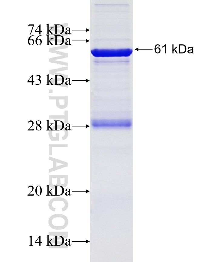 IMMT fusion protein Ag0102 SDS-PAGE