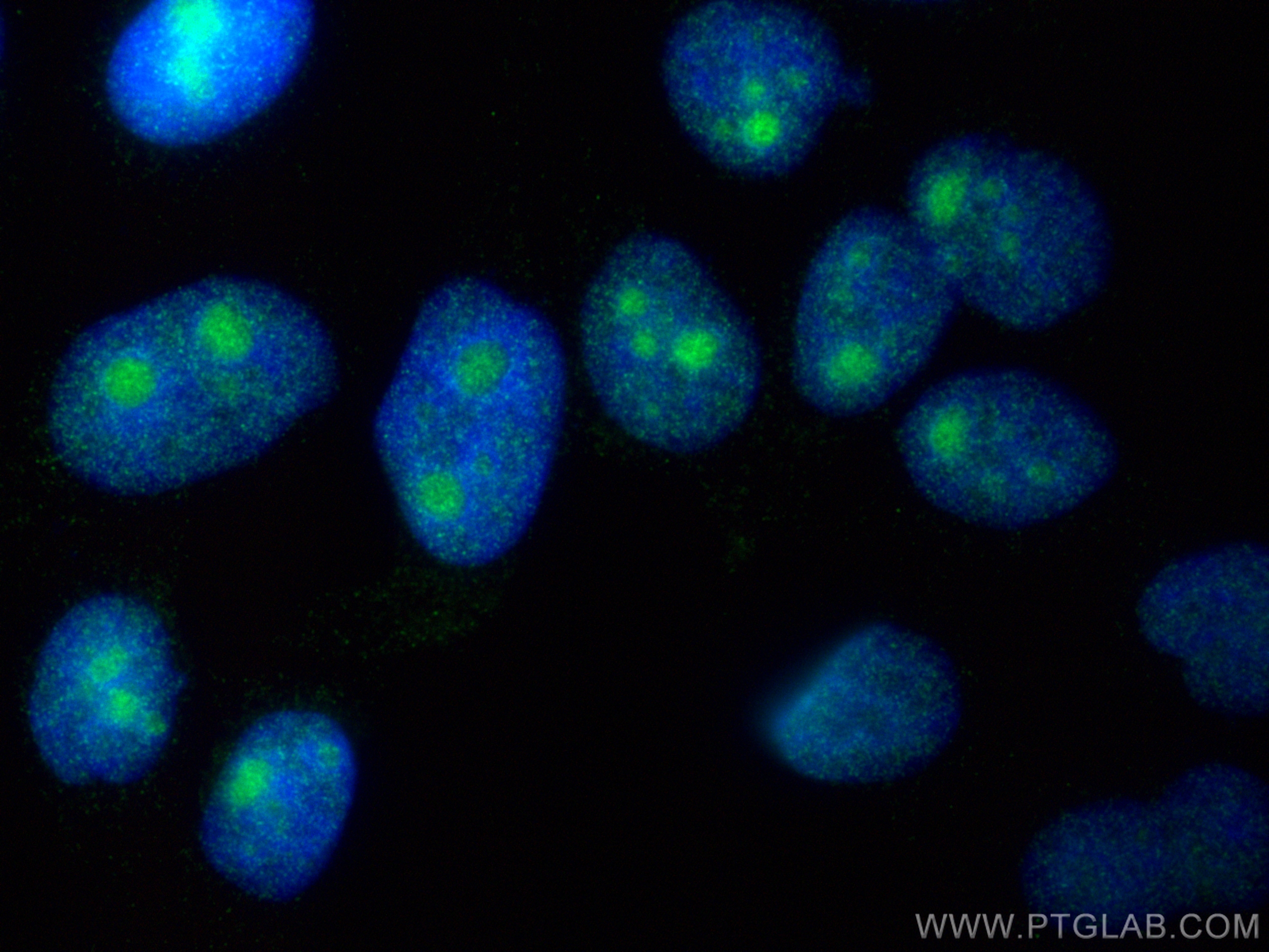 IF Staining of HepG2 using 12750-1-AP