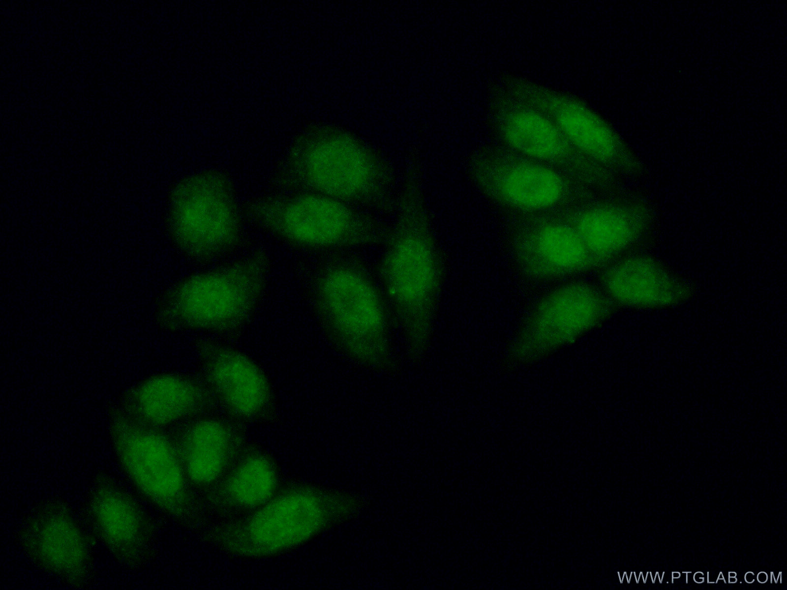 IF Staining of HeLa using 12750-1-AP