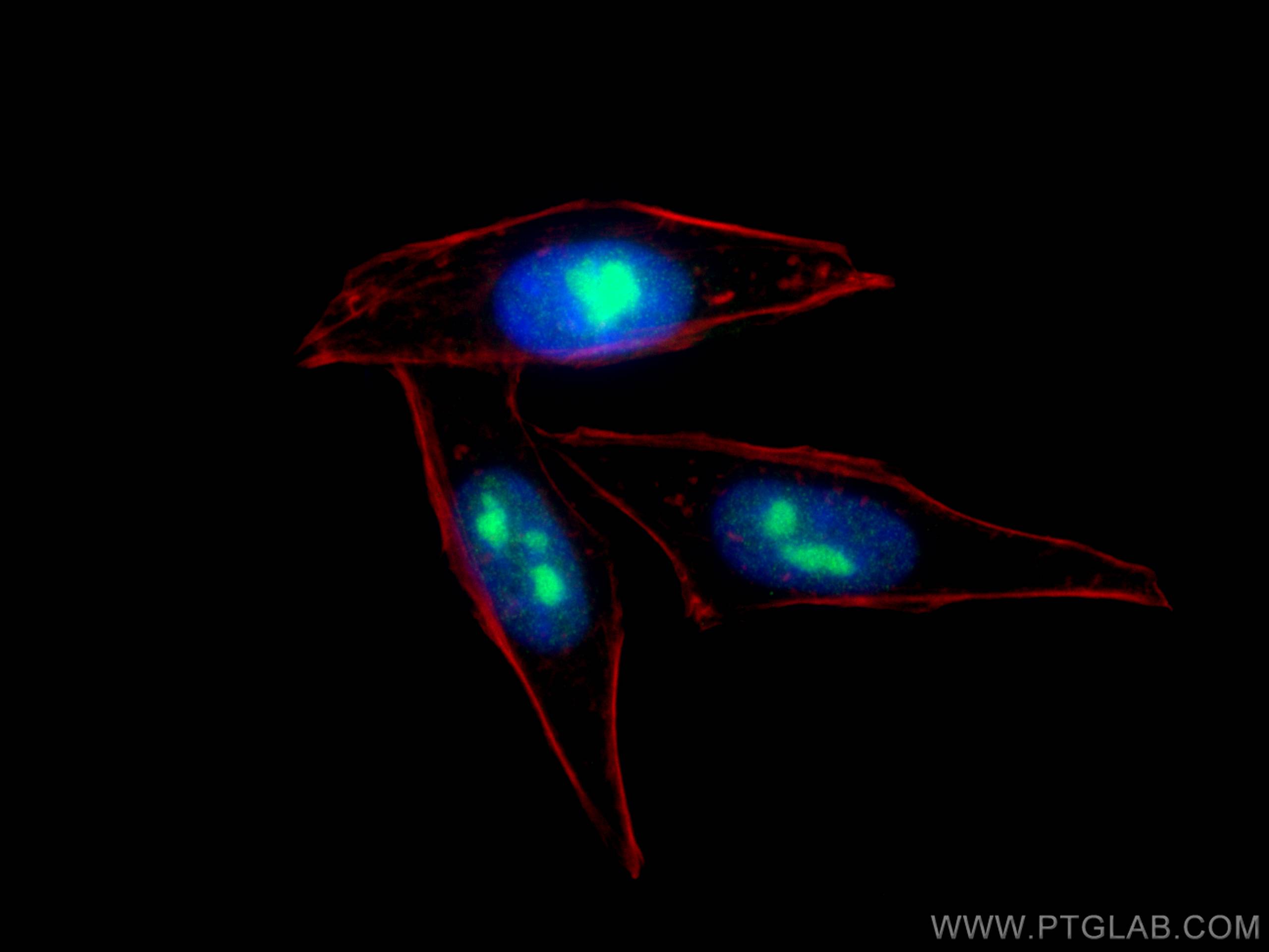 IF Staining of HepG2 using 66247-1-Ig (same clone as 66247-1-PBS)