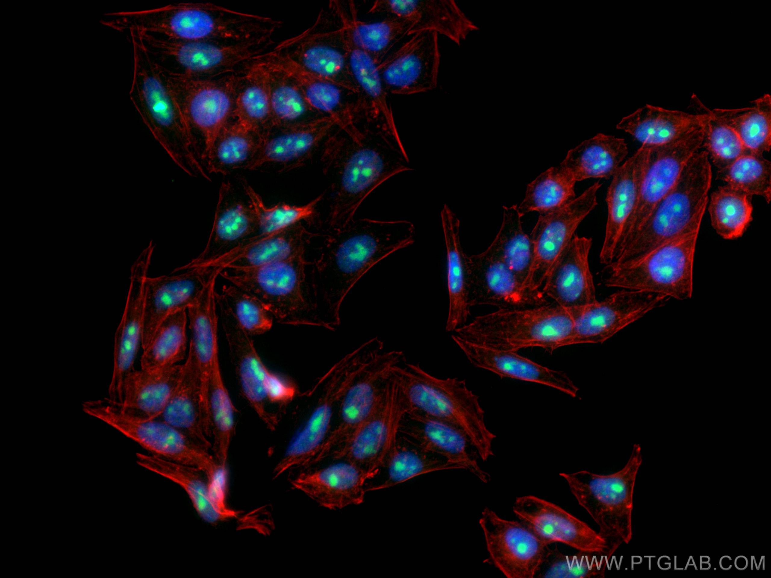 IF Staining of HepG2 using 66247-1-Ig (same clone as 66247-1-PBS)