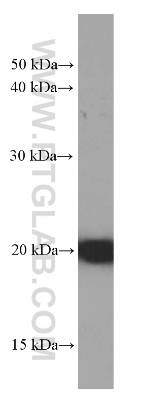 WB analysis of HeLa using 66247-1-Ig (same clone as 66247-1-PBS)
