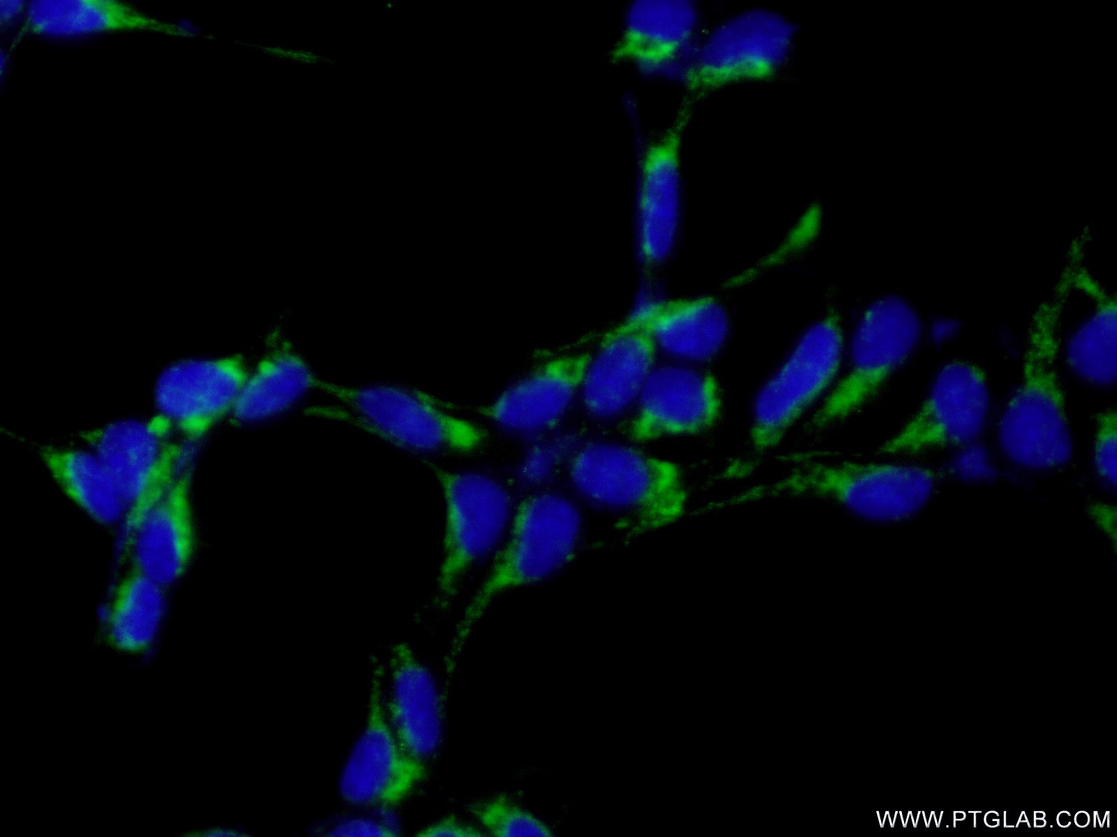 IF Staining of HEK-293 using 12664-1-AP