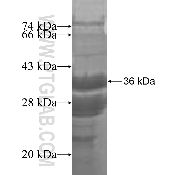 IMP5 fusion protein Ag9134 SDS-PAGE IMP5 fusion protein Ag9134 SDS-PAGE