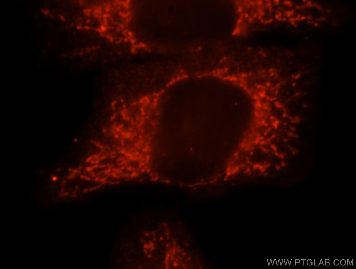 IF Staining of HepG2 using 16593-1-AP