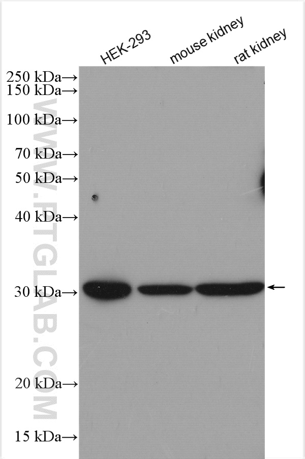 WB analysis using 16593-1-AP