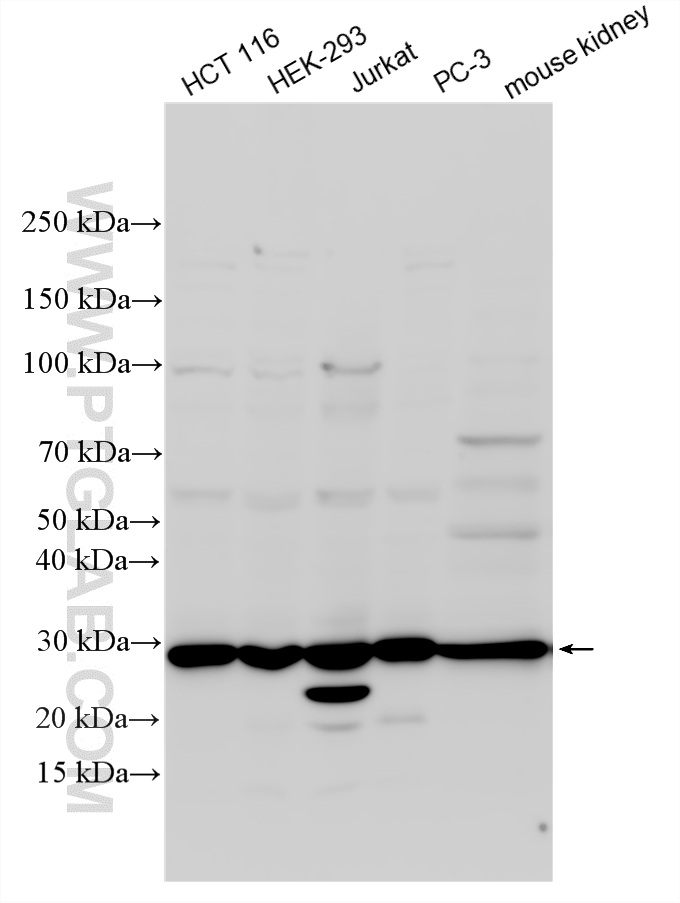 Various lysates were subjected to SDS PAGE followed by western blot with 16593-1-AP (IMPA1 antibody) at dilution of 1:2000 incubated at room temperature for 1.5 hours. WB analysis using 16593-1-AP