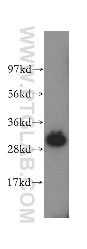 WB analysis of human kidney using 16593-1-AP