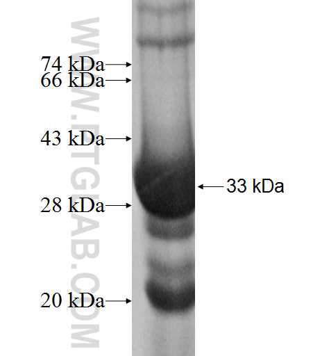 IMPA2 fusion protein Ag8831 SDS-PAGE IMPA2 fusion protein Ag8831 SDS-PAGE
