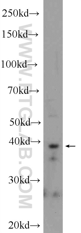 WB analysis of 3T3-L1 using 25739-1-AP