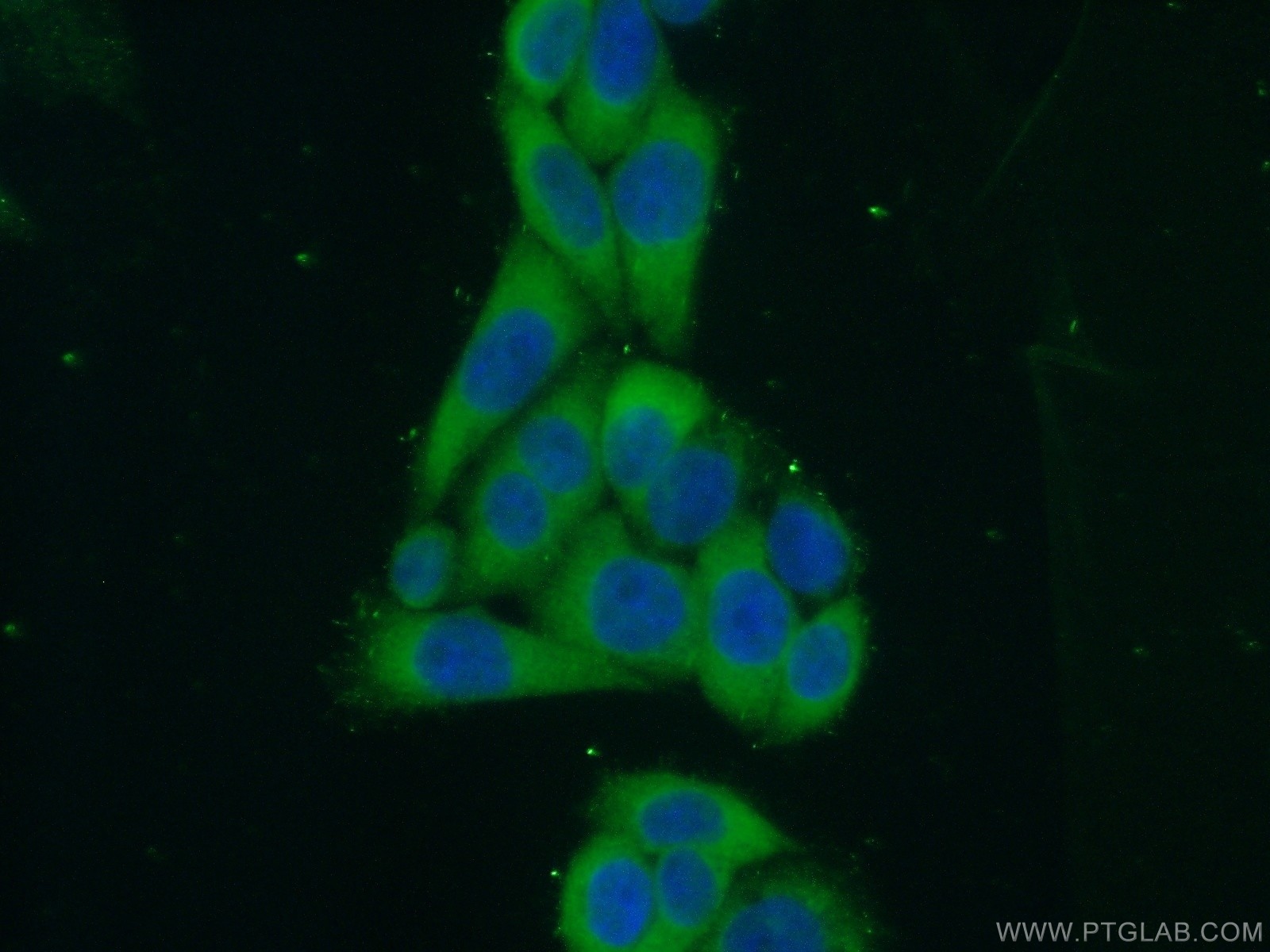 IF Staining of HeLa using 22092-1-AP