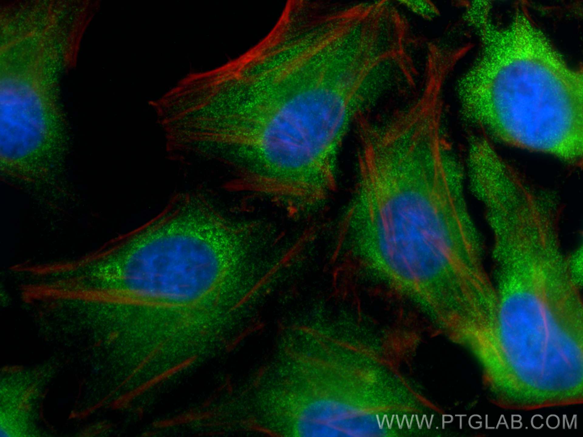 IF Staining of HeLa using 12948-1-AP