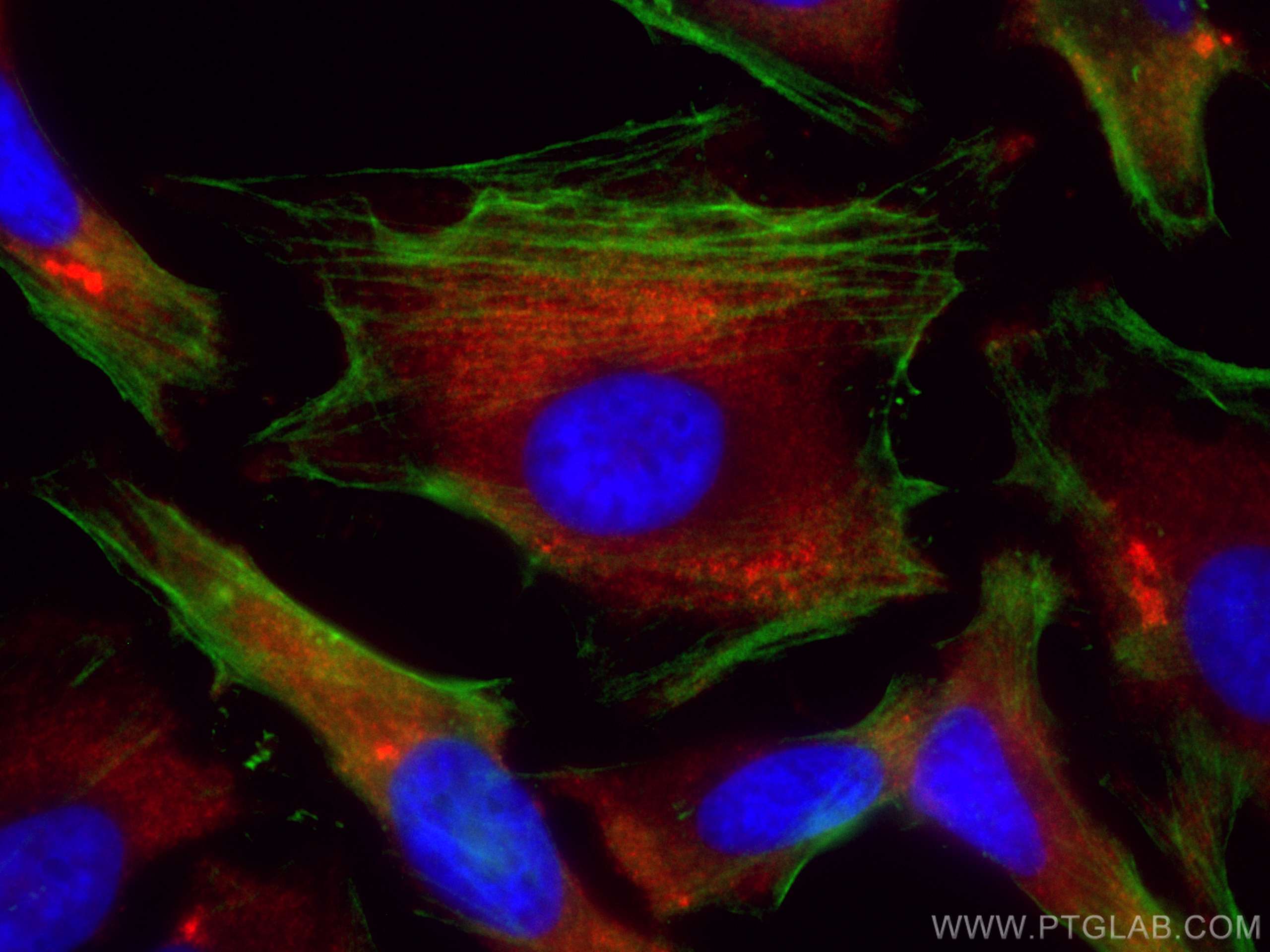 IF Staining of HeLa using CL594-12948