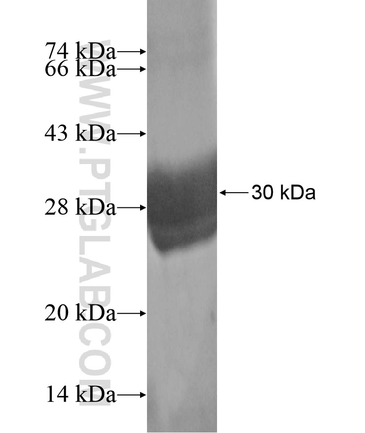 IMPDH2 fusion protein Ag17296 SDS-PAGE IMPDH2 fusion protein Ag17296 SDS-PAGE