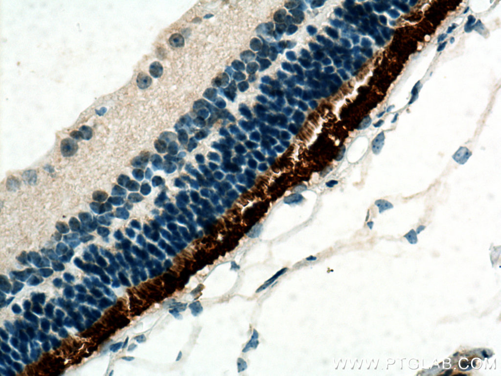 IHC staining of mouse eye using 19895-1-AP