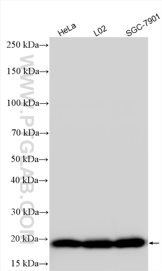 WB analysis using 25561-1-AP (same clone as 25561-1-PBS) WB analysis using 25561-1-AP (same clone as 25561-1-PBS)