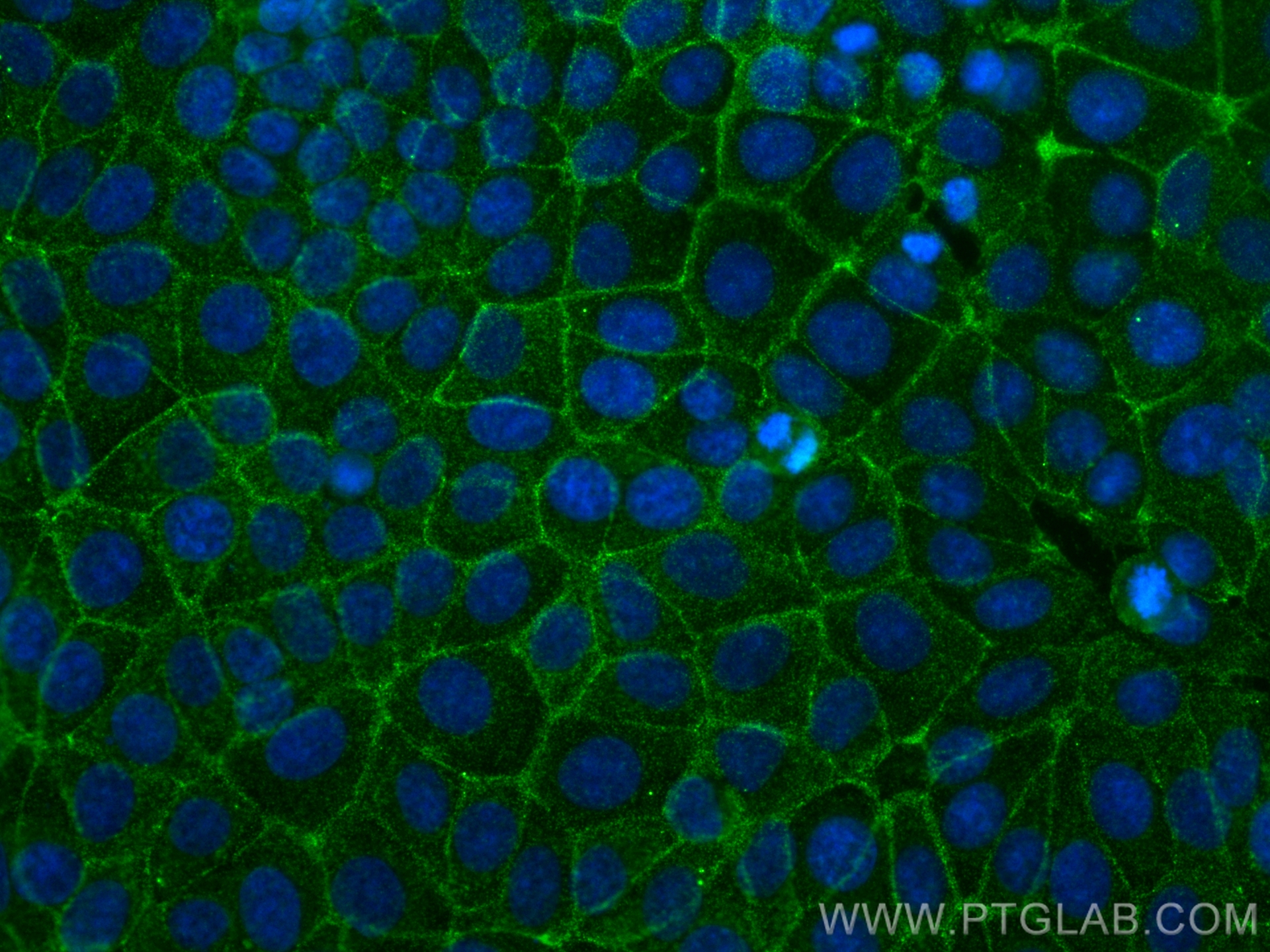 IF Staining of MCF-7 using 67833-1-Ig
