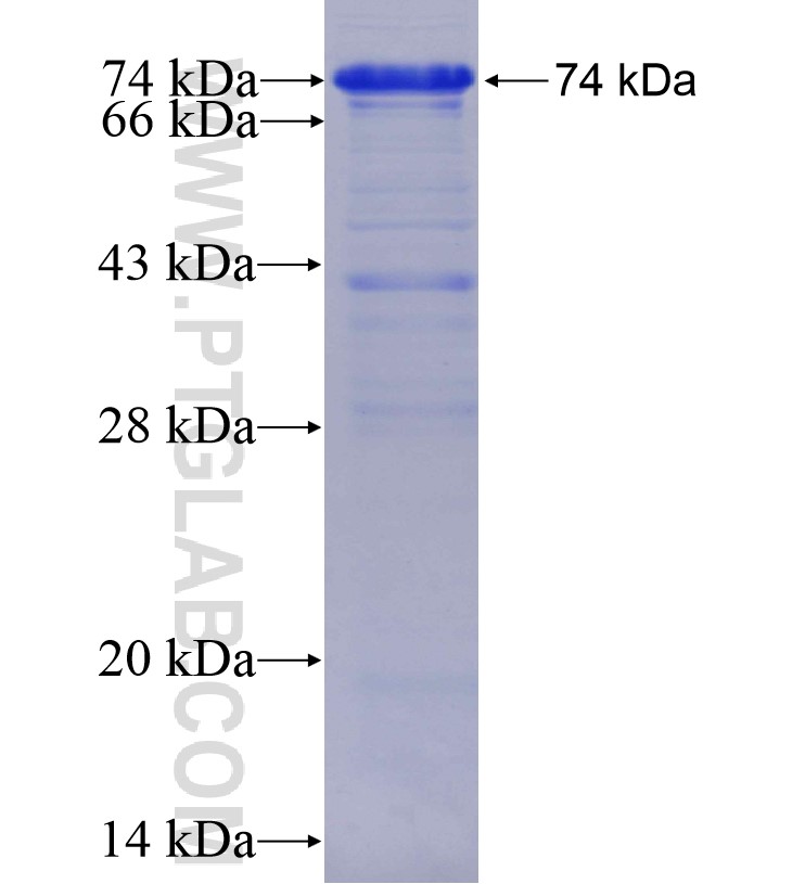 INADL fusion protein Ag15532 SDS-PAGE INADL fusion protein Ag15532 SDS-PAGE
