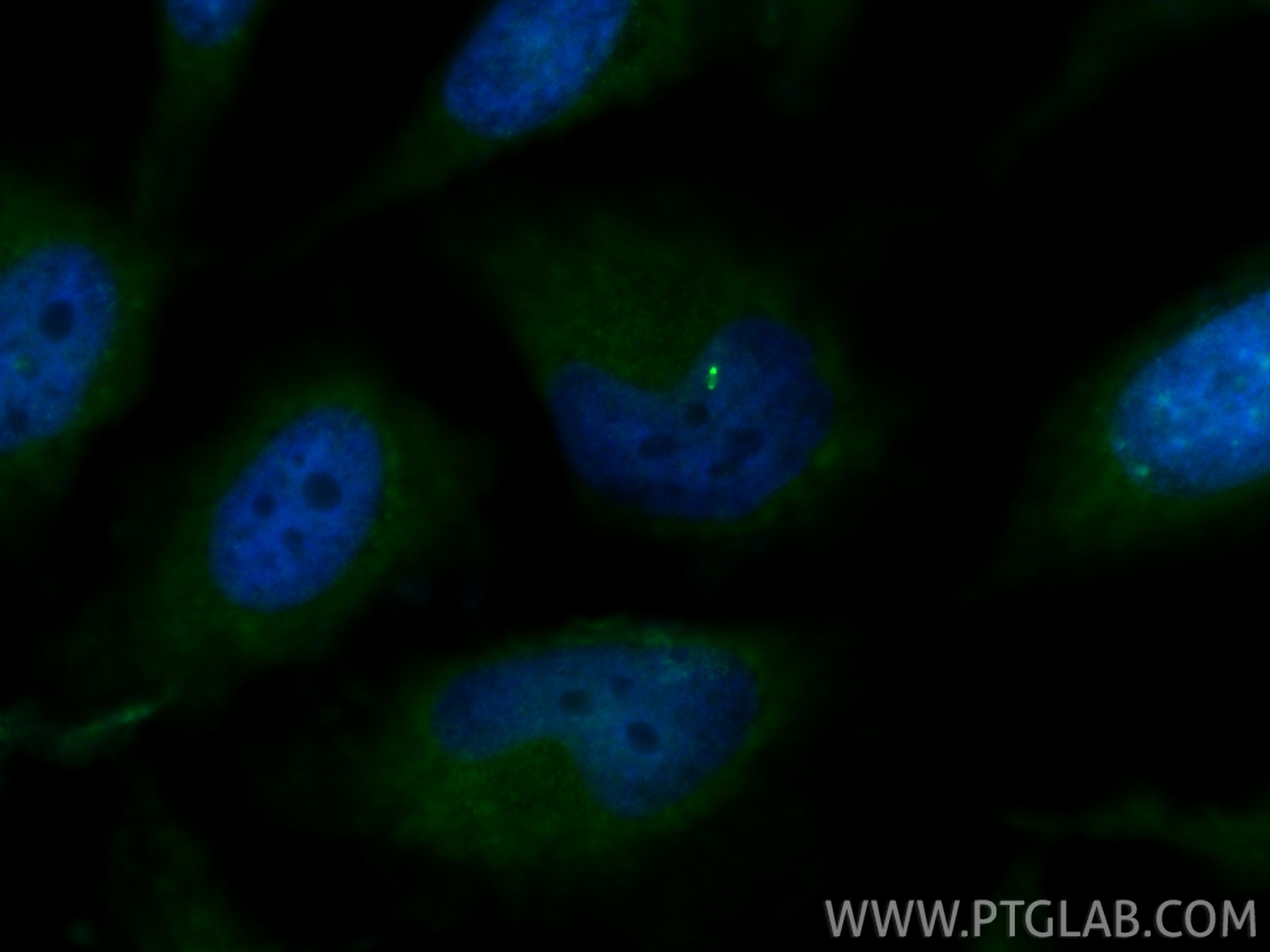 Immunofluorescent analysis of (4% PFA) fixed HeLa cells using INCENP antibody (29419-1-AP) at dilution of 1:200 and CoraLite®488-Conjugated Goat Anti-Rabbit IgG(H+L) (<a class='green' href='/productredirect?CatalogNo=SA00013-2' target='_blank'>SA00013-2</a>). IF Staining of HeLa using 29419-1-AP