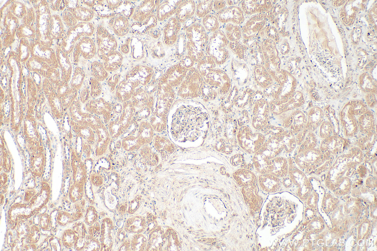 Immunohistochemical analysis of paraffin-embedded human kidney tissue slide using 20466-1-AP (INF2 antibody) at dilution of 1:400 (under 10x lens). Heat mediated antigen retrieval with Tris-EDTA buffer (pH 9.0). IHC staining of human kidney using 20466-1-AP