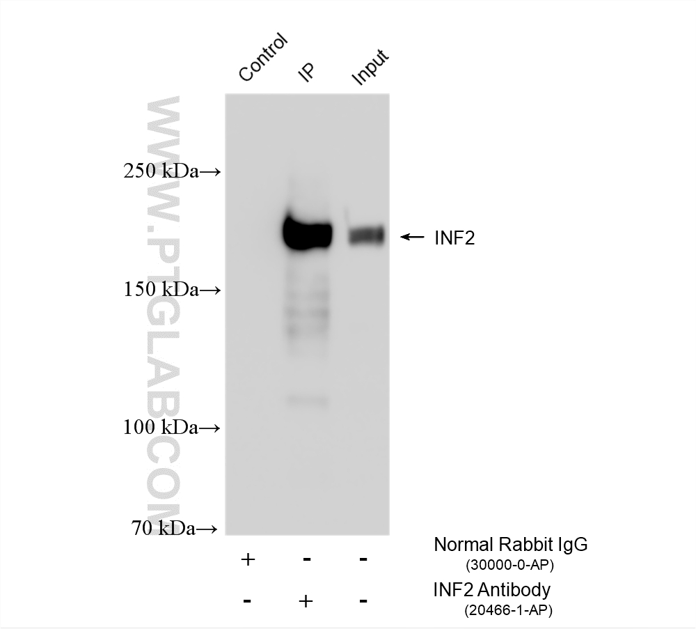 IP result of anti-INF2 (IP:20466-1-AP, 4ug; Detection:20466-1-AP 1:4000) with NIH/3T3 cells lysate 1200 ug. IP experiment of NIH/3T3 using 20466-1-AP