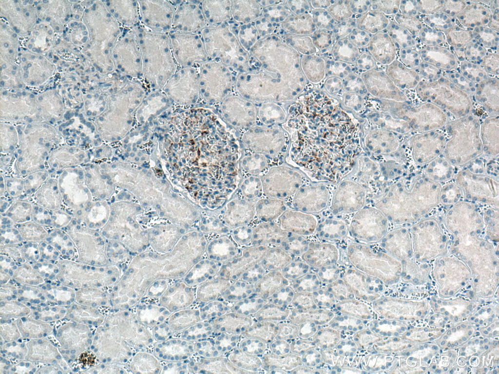 IHC staining of human kidney using 66910-1-Ig