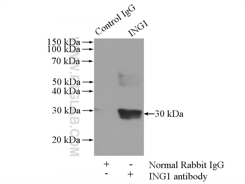 IP experiment of mouse heart using 16185-1-AP