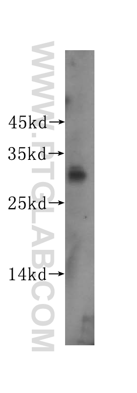 ING1-specific Polyclonal antibody