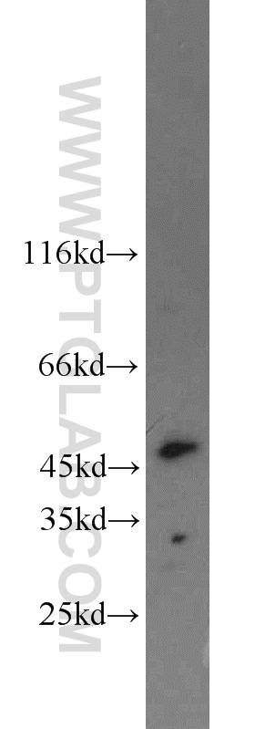 WB analysis of mouse uterus using 10905-1-AP