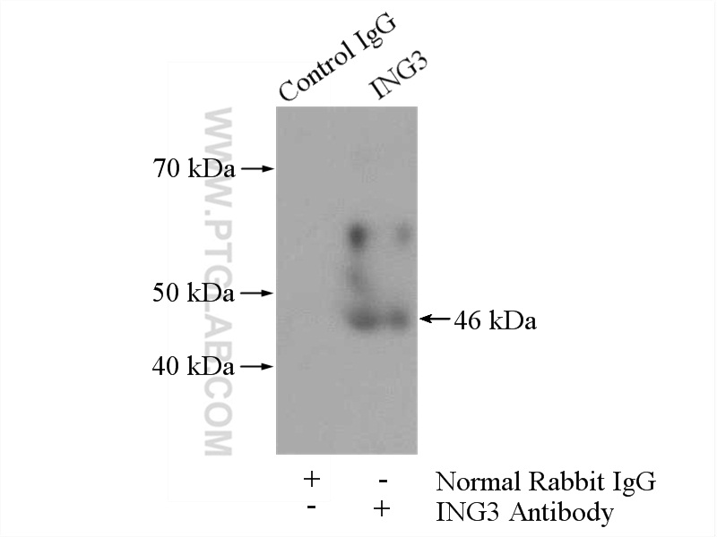IP experiment of mouse kidney using 16187-1-AP