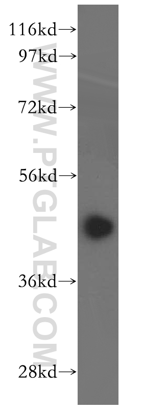 WB analysis of human kidney using 16187-1-AP