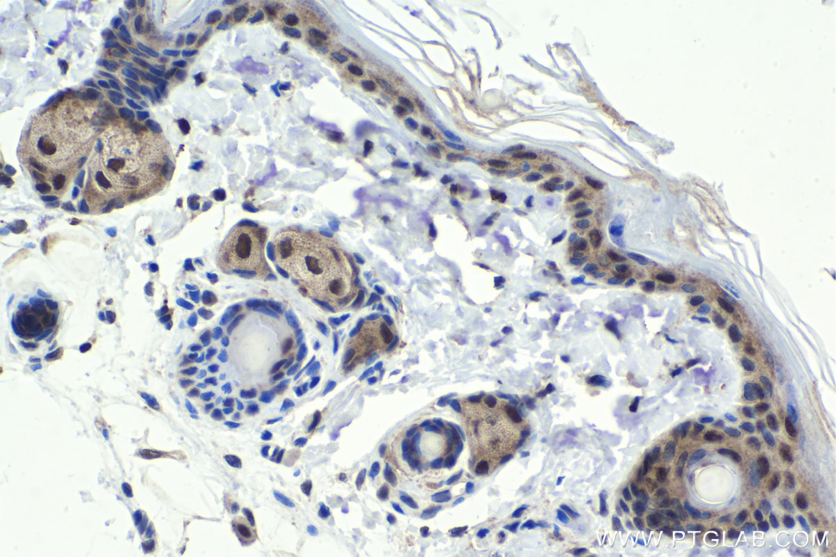 IHC staining of rat skin using 10665-1-AP (same clone as 10665-1-PBS)