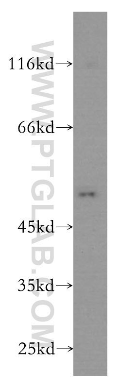 WB analysis of human brain using 60015-1-Ig