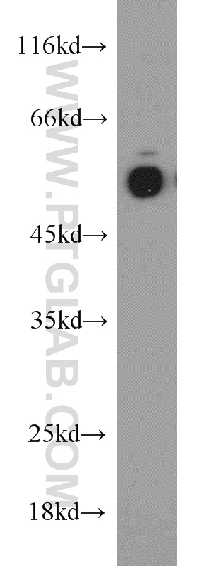 WB analysis of rat brain using 17524-1-AP