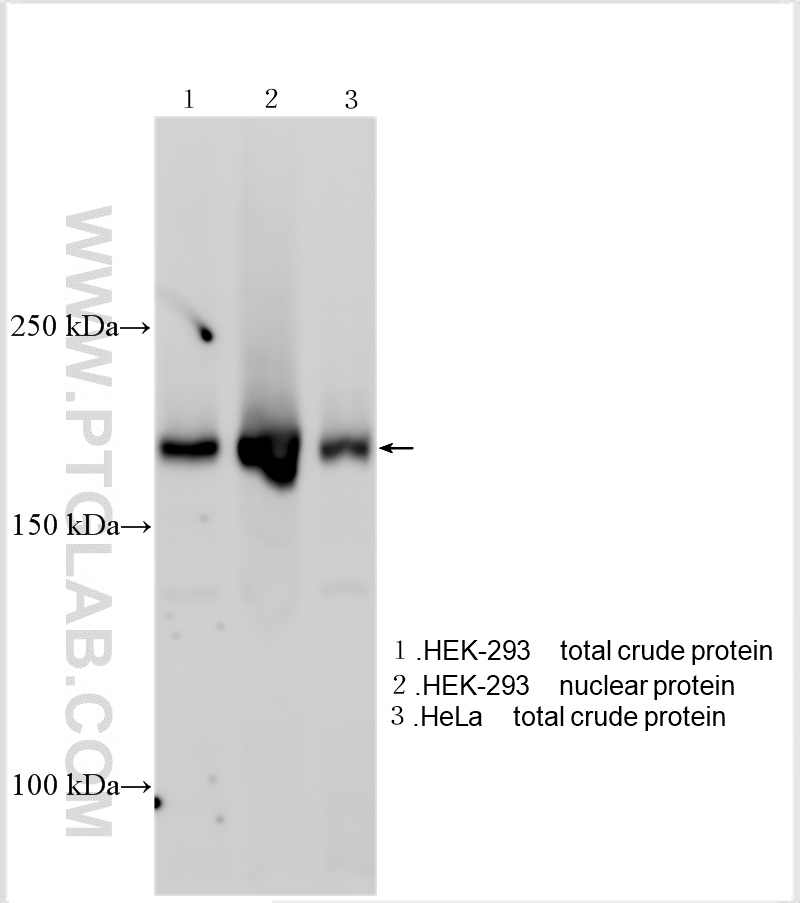 Various lysates were subjected to SDS PAGE followed by western blot with 18810-1-AP (INO80 antibody) at dilution of 1:2000 incubated at room temperature for 1.5 hours. WB analysis using 18810-1-AP