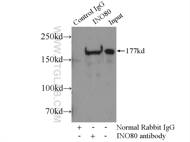 IP experiment of HeLa using 24819-1-AP