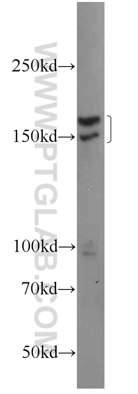 WB analysis of HeLa using 24819-1-AP