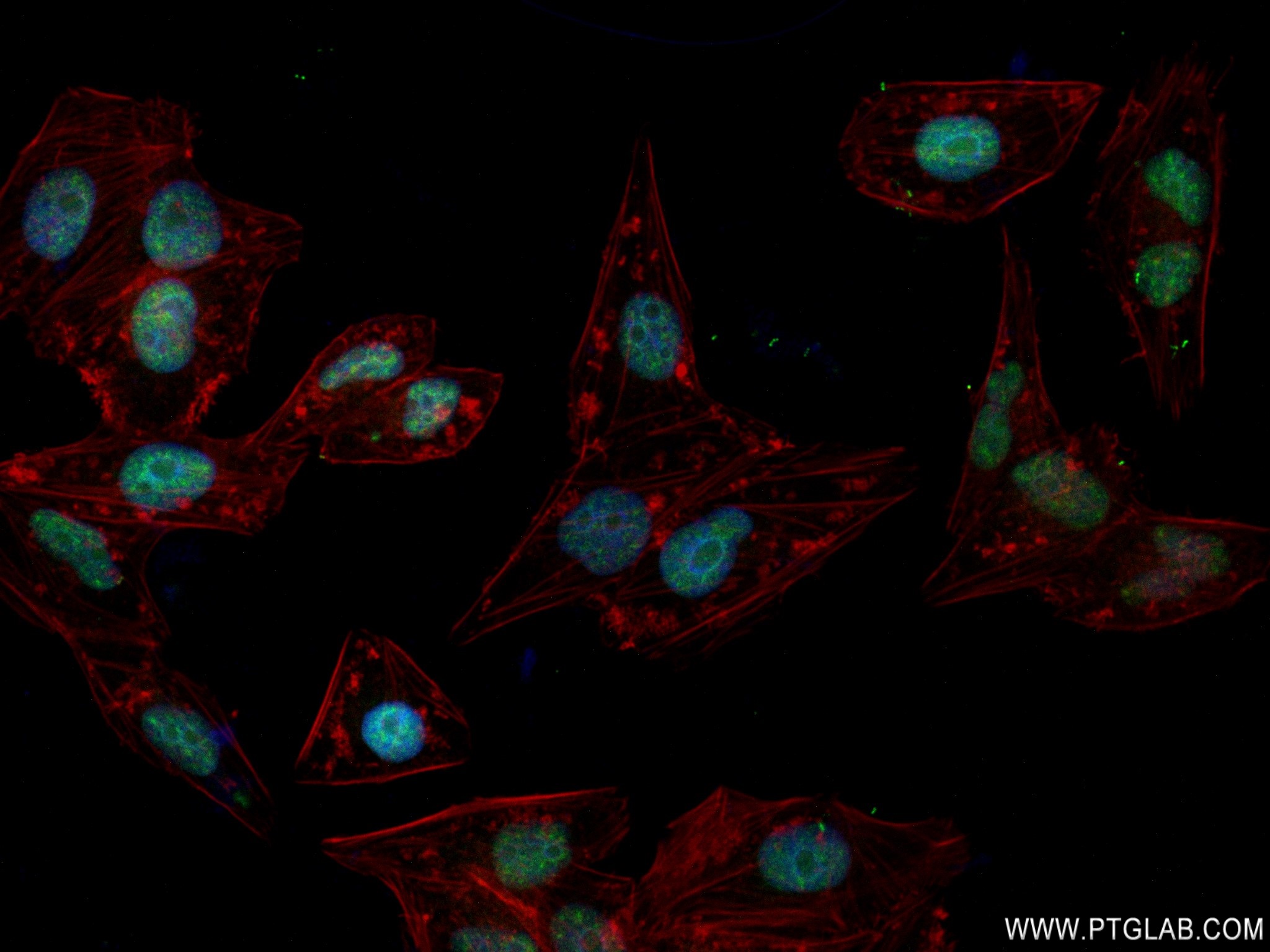 IF Staining of HepG2 using 83117-4-RR