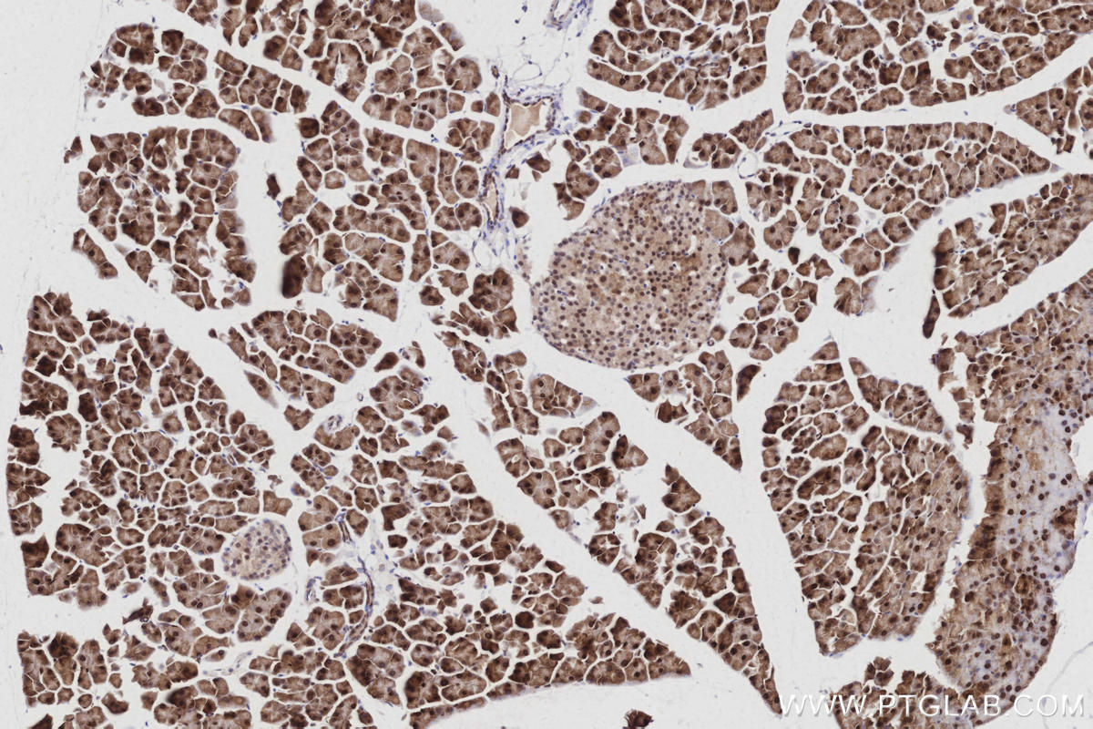 IHC staining of mouse pancreas using 83117-4-RR IHC staining of mouse pancreas using 83117-4-RR