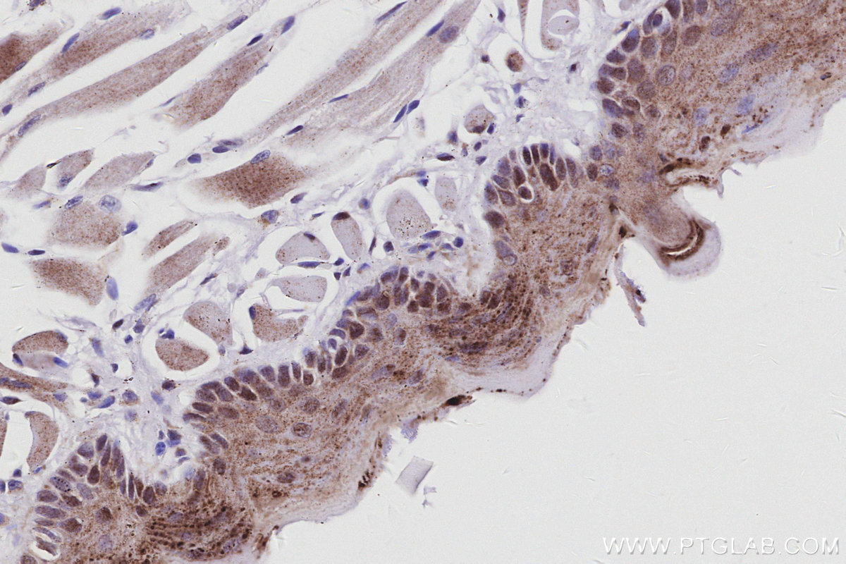 IHC staining of mouse tongue using 83117-4-RR IHC staining of mouse tongue using 83117-4-RR