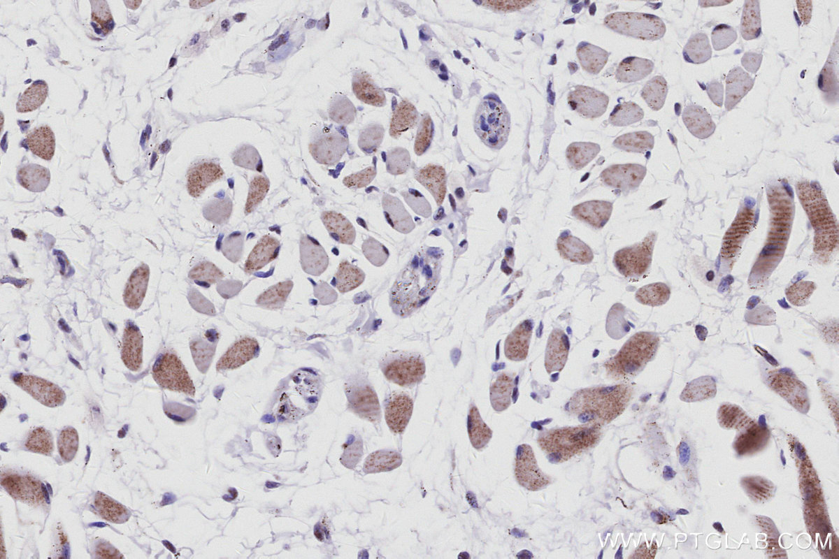IHC staining of mouse tongue using 83117-4-RR IHC staining of mouse tongue using 83117-4-RR