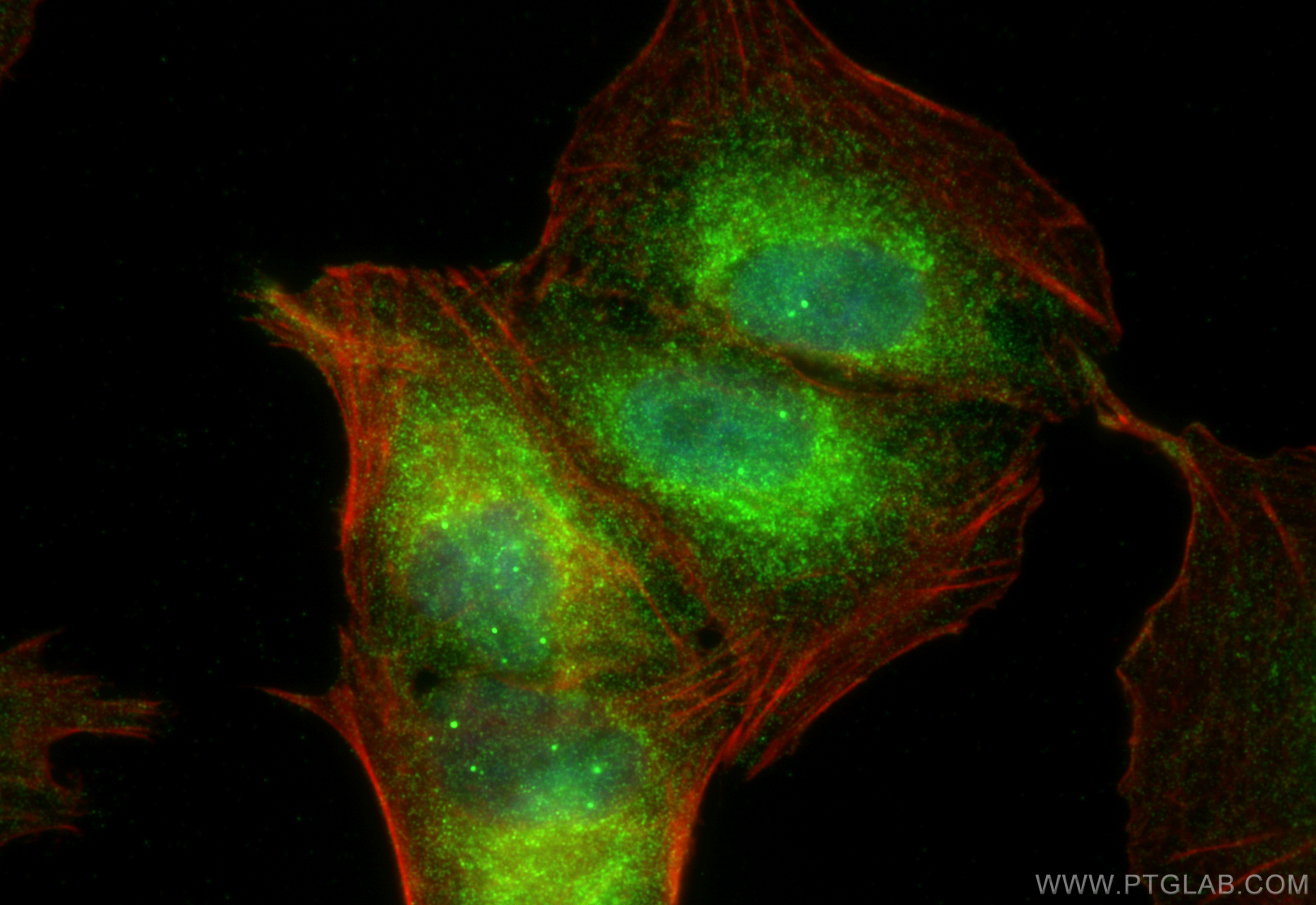 IF Staining of A549 using 12665-1-AP